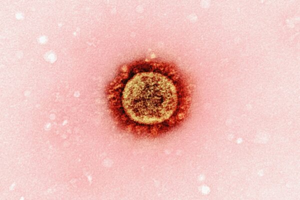 a close up of a red substance on a pink background