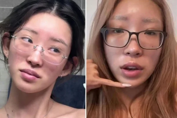 Choi Jun Hee surpreende com transformação de rosto sem